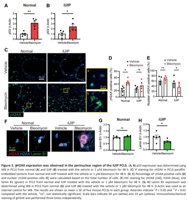 Western blot, immunofluorescence, and quantification of γH2AX and Lamin B1 in bleomycin-treated precision-cut lung slices from normal and iUIP tissue.