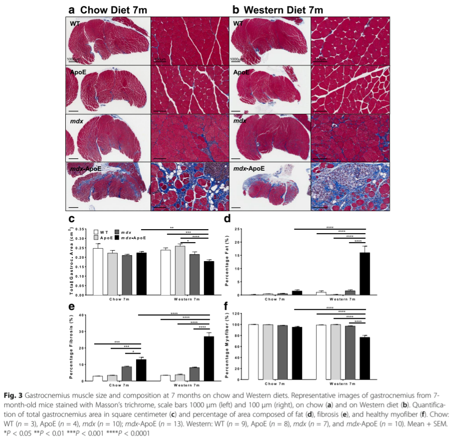 Masson’s trichrome histology and composition graphs of gastrocnemius muscle in wild-type, ApoE, mdx, and mdx-ApoE mice on chow versus Western diets.